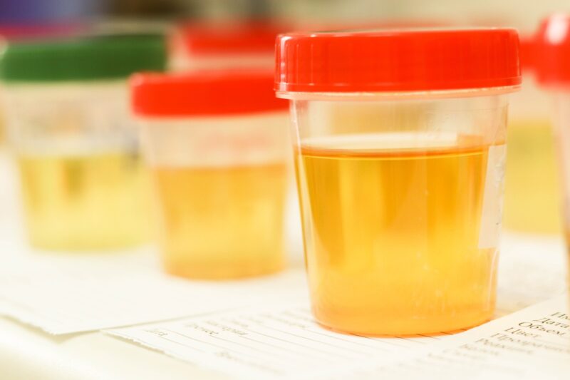 Urine Alcohol Test - Self Administered