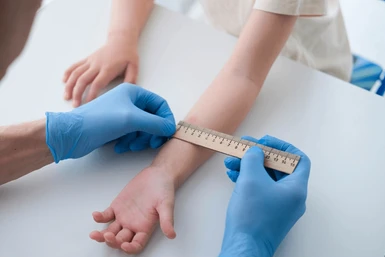 Tuberculosis (TB) Skin Test