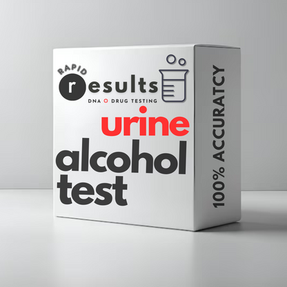 Urine Alcohol Test