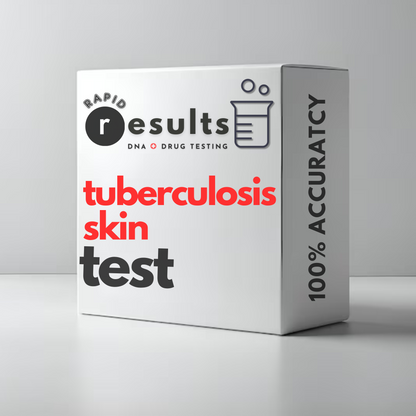 Tuberculosis (TB) Skin Test