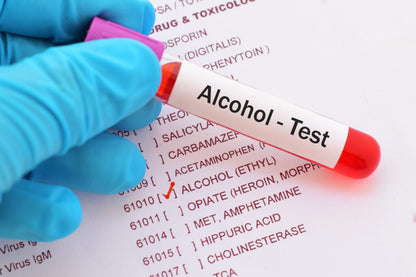 Blood Alcohol Test