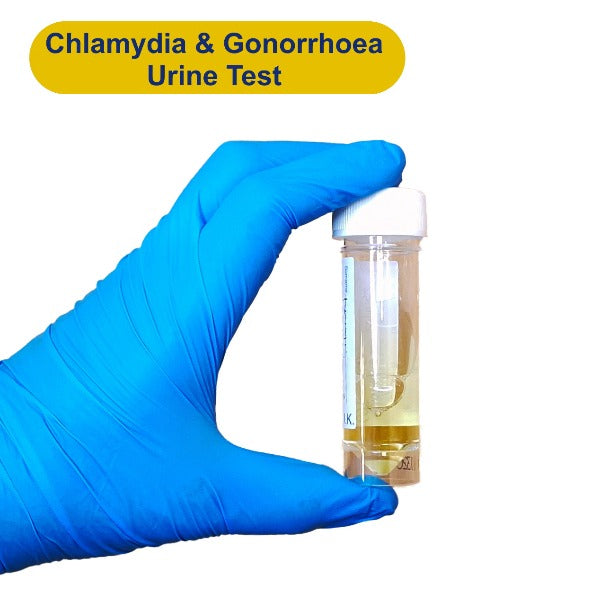 Chlamydia + Gonorrhea Test