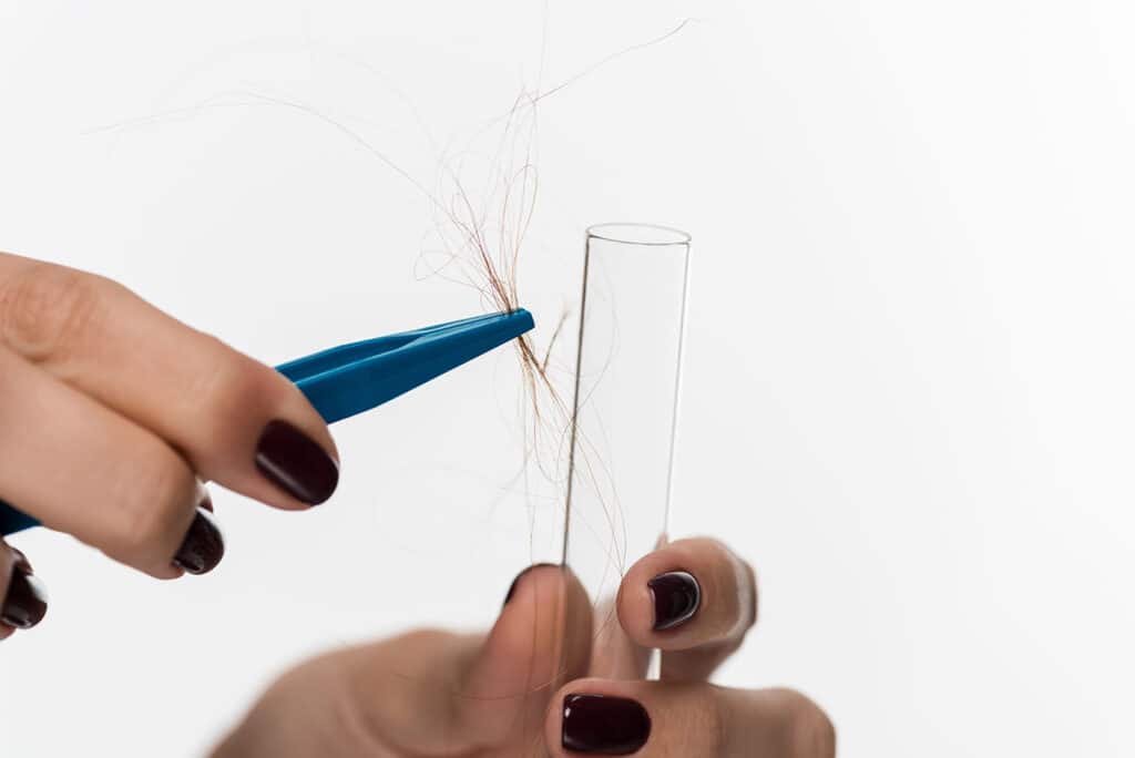 Hair Follicle Alcohol Test