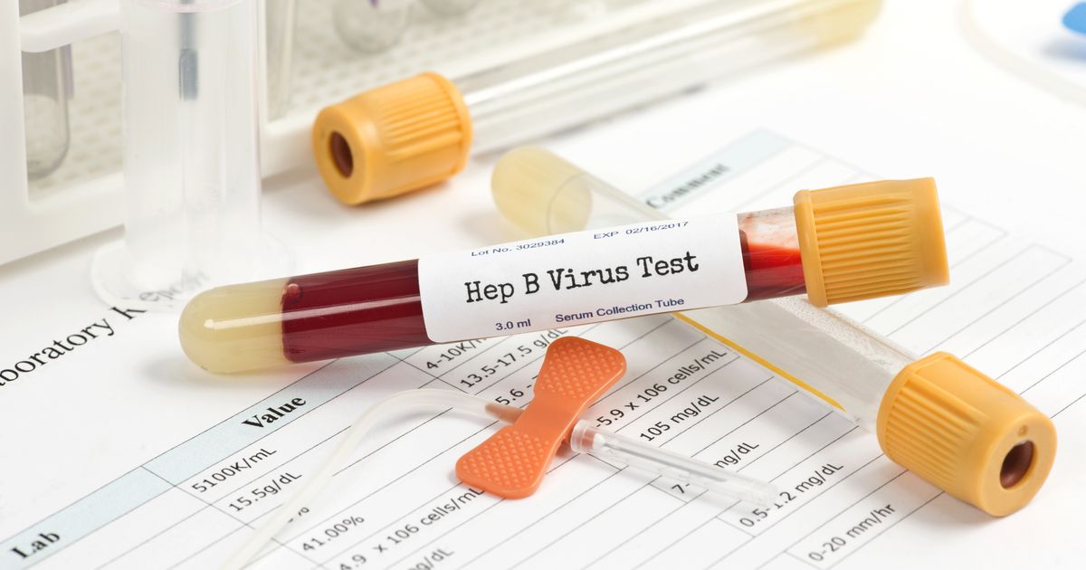 Hepatitis B Test