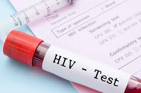 HIV + AIDS Test