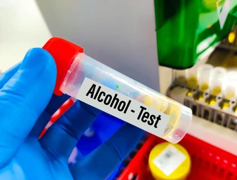 Urine Alcohol Test